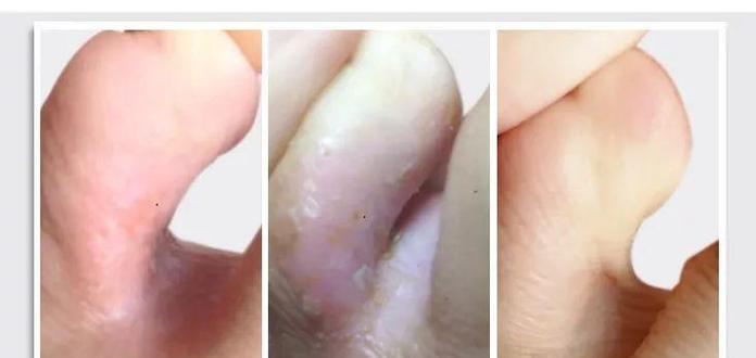 经典案例恢复为主题的重要性（揭示经典案例恢复为主题的关键方法和价值）